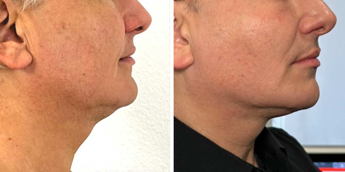 before-after-03